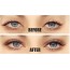 Αυτοκόλλητο Ανόρθωσης Βλεφάρου Eyelid Lift Strips 810 Τεμάχια