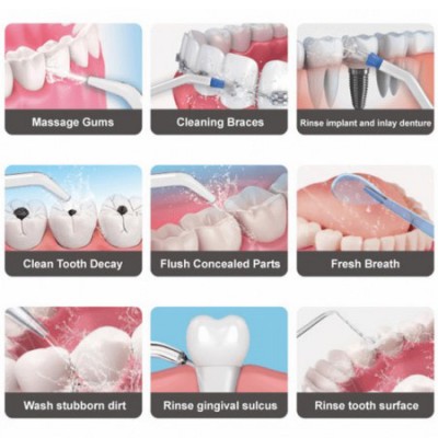Waterpulse Οδοντιατρικό Σύστημα Καθαρισμού Δοντιών με Δοχείο Νερού 1lt & 5 Εξαρτήματα Κεφαλές Water Flosser