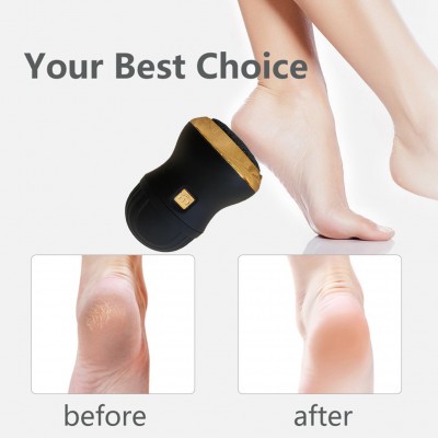 Επαναφορτιζόμενη Συσκευή Περιποίησης Πέλματος και Απομάκρυνσης Κάλων - Callus Remover Foot Cleaner